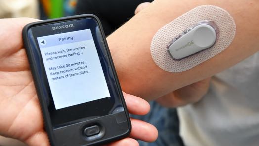 DexCom Inc Forecast for 2022 and 2023